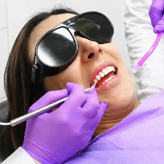 What Is Tooth Bonding: How Long Does It Last?