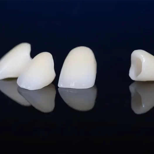 Dental Crowns: The Durable Solution for  Cracked or Broken Teeth